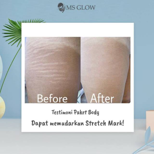 MS Glow Body Lotion - 1 Item - Pemutih Badan