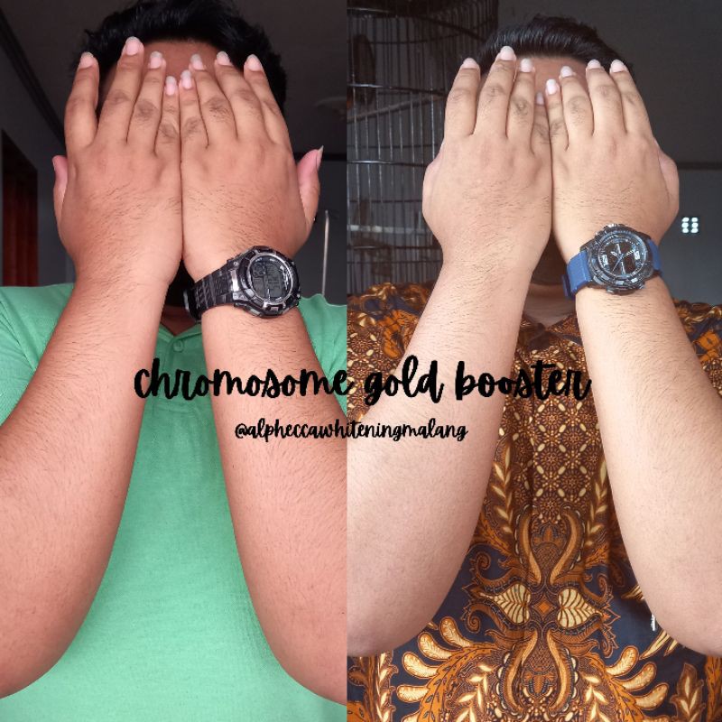 chromosome gold booster