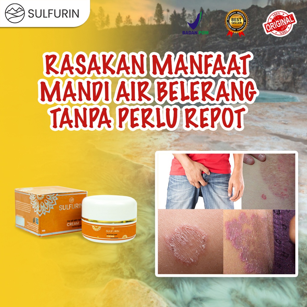 Sulfurin obat salep gatal selangkangan menahun kulit bintik merah Scabies Herpes ampuh BPOM