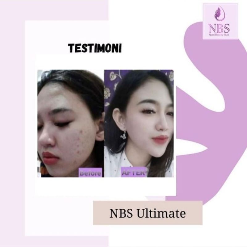 skincare viral NBS ori 100%