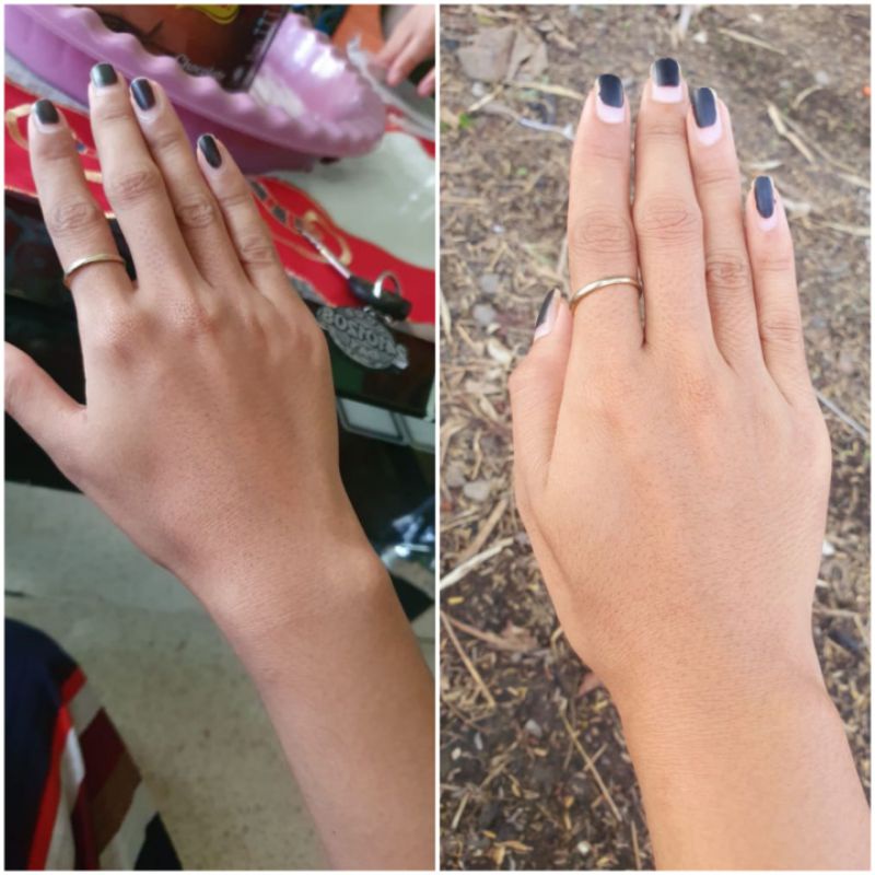 infus whitening cocktail kromosom