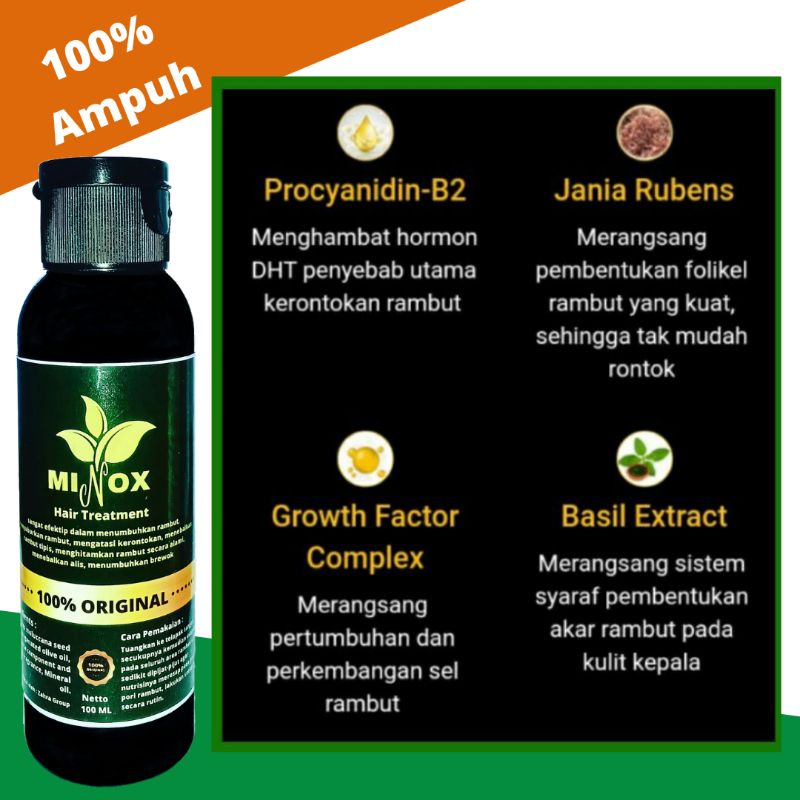 [MINOX] Obat Penumbuh Rambut Botak, Tipis dan Rontok Super Cepat Original Ampuh isi 100 ML-2