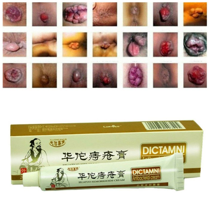 Dictamni Hemorhoid Cream/Salep Wasir Herbal China/Krim Ambeyen - 20 Gr