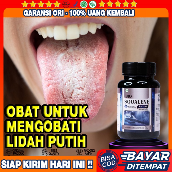 Obat Alami Lidah Putih - Obat Lidah Mati Rasa - Obat Lidah Berjamur - Obat Lidah Bernanah - Obat Lid