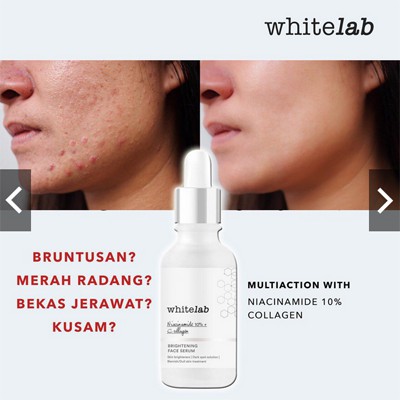 [5 pcs ] ORIGINAL 100% Whitelab Brightening Paket Wajah LENGKAP