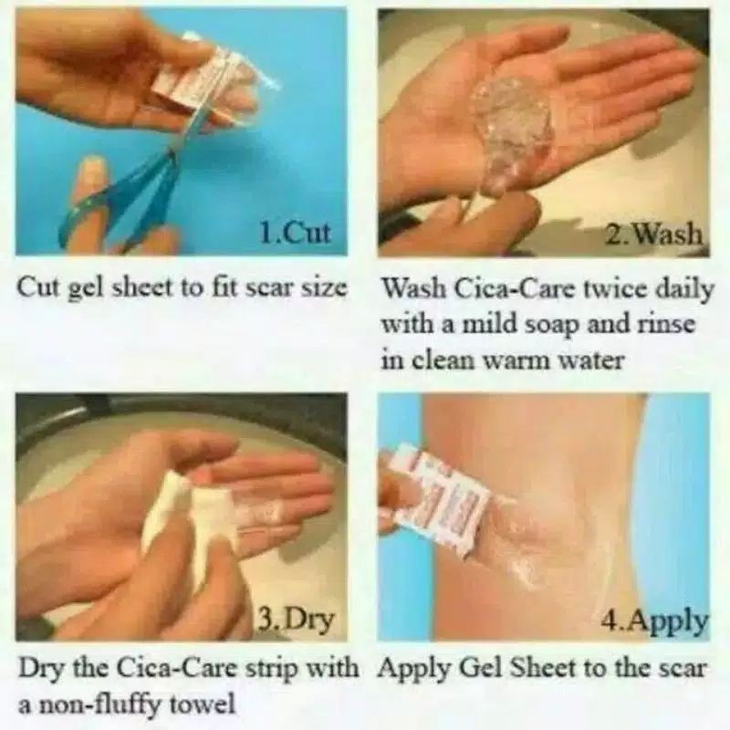 cica care obat keloid obat pasca operasi size 5 x 1 cm