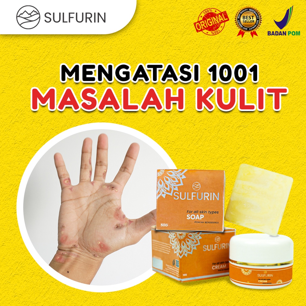 Sabun dan Salep SULFURIN BELERANG Mengatasi Gatal Pada Kulit Obat Skabies Herpes Kutu Air 100% Original BPOM Aman Untuk Segala Usia