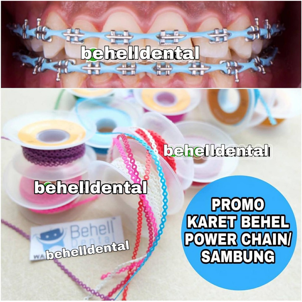 TEBAL KUAT KARET BEHEL POWER CHAIN 50CM ATAU 1/2 METER PREMIUM / KARET TARIK / KARET SAMBUNG RUBBER BAND Karet Kawat Braces Dental Ortho BRACKET GIGI MOTIF - Ligature Tie Ties SUPER - BEHELLDENTAL