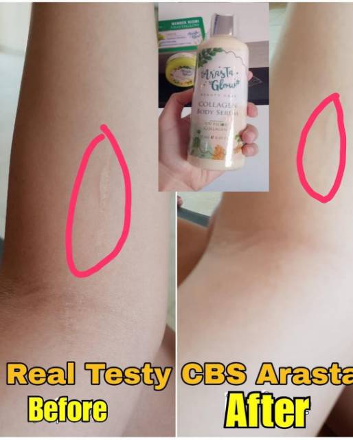 BODY SERUM COLLAGEN ARASTA