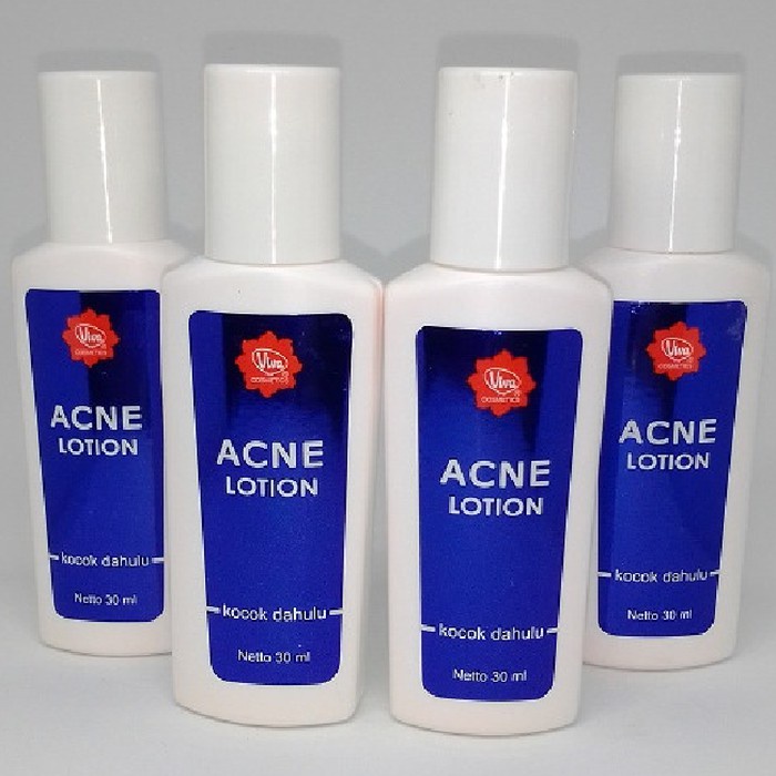 [Original] Viva Acne Lotion Ekfektif Menghilangkan Jerawat Obat Jerawat 30 ml