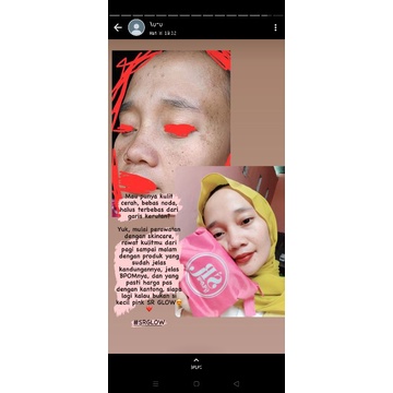 SR GLOW PLATINUM BPOM COCOK BUAT SEMUA JENIS KULIT