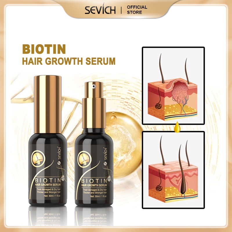 SEVICH BIOTIN Hair Growth Serum Tret Damaged &amp; Dry Hair 30ml