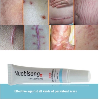 KESEHATAN OBAT - OBATAN NUOBISONG OBAT PENGHILANG BEKAS LUKA / JERAWAT / SELULIT SCAR GEL
