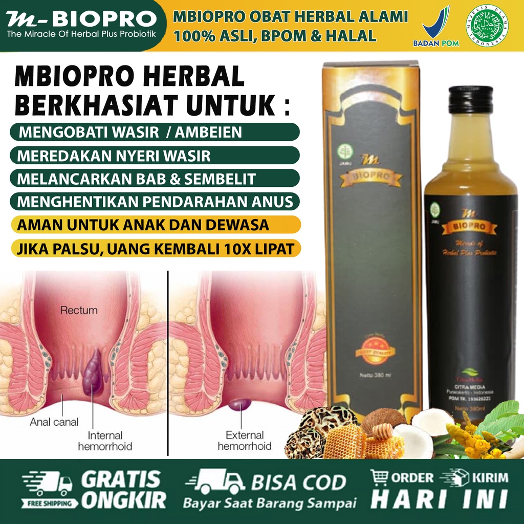 Obat Ambeien Paling Ampuh, Ambeien Stadium 4, BAB Berdarah, Wasir Ambeyen, Wasir Cina, Sakit Anus, B