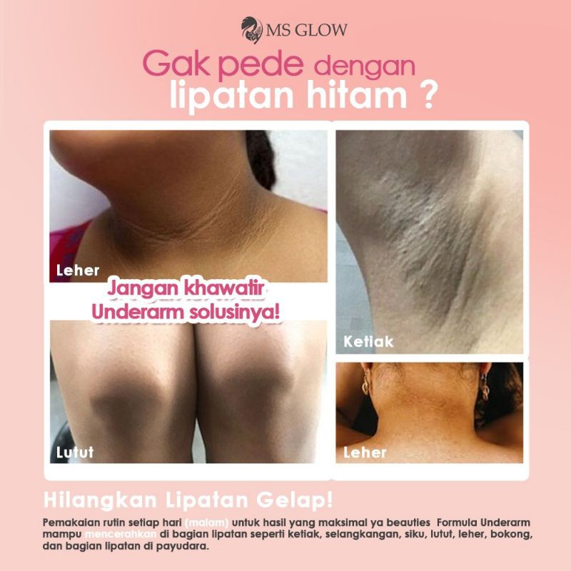 underarm ms glow pemutih ketiak lipatan ms glow