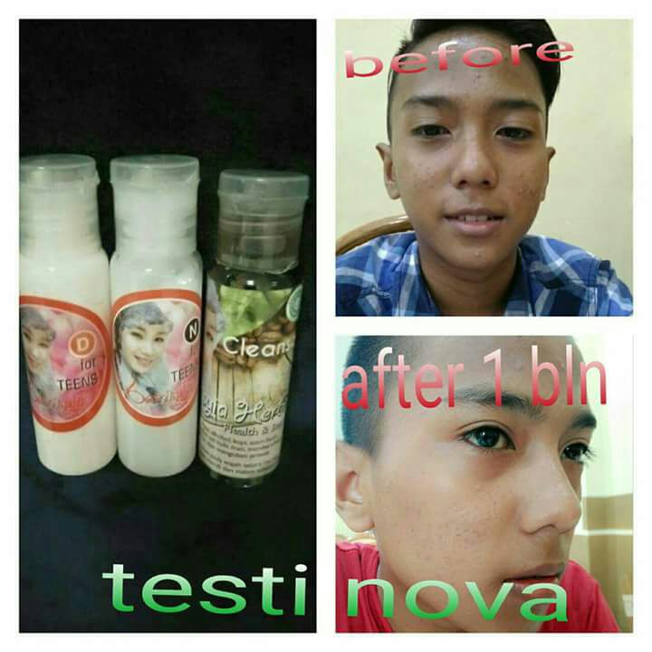 Paket Teens Care Batrisyia Herbal (Day Cream, Night Cream, Toner)