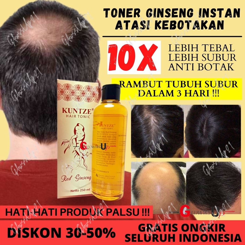 KUNTZE HAIR TONIC RED GINSENG 250ML BPOM - TONIC KUNTZE RED GINSENG