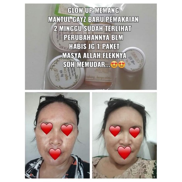GLOW UP SKINCARE ORIGINAL BY AB