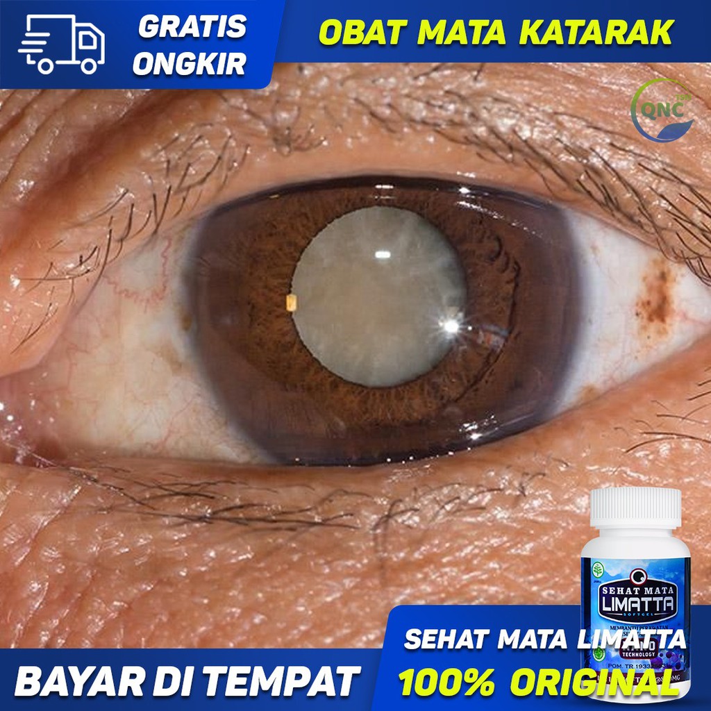 Obat Mata Katarak, Katarak Traumatik, Katarak Sekunder, Katarak Kongenital - Sehat Mata Limatta