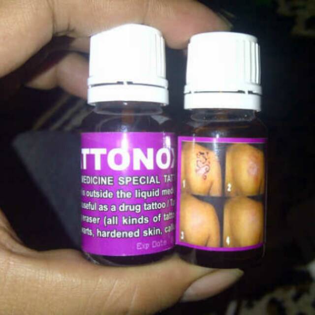 Promo Grosir Obat Penghilang Penghapus Remover Remofet Tato Tatto Tatonox Tattonox Original