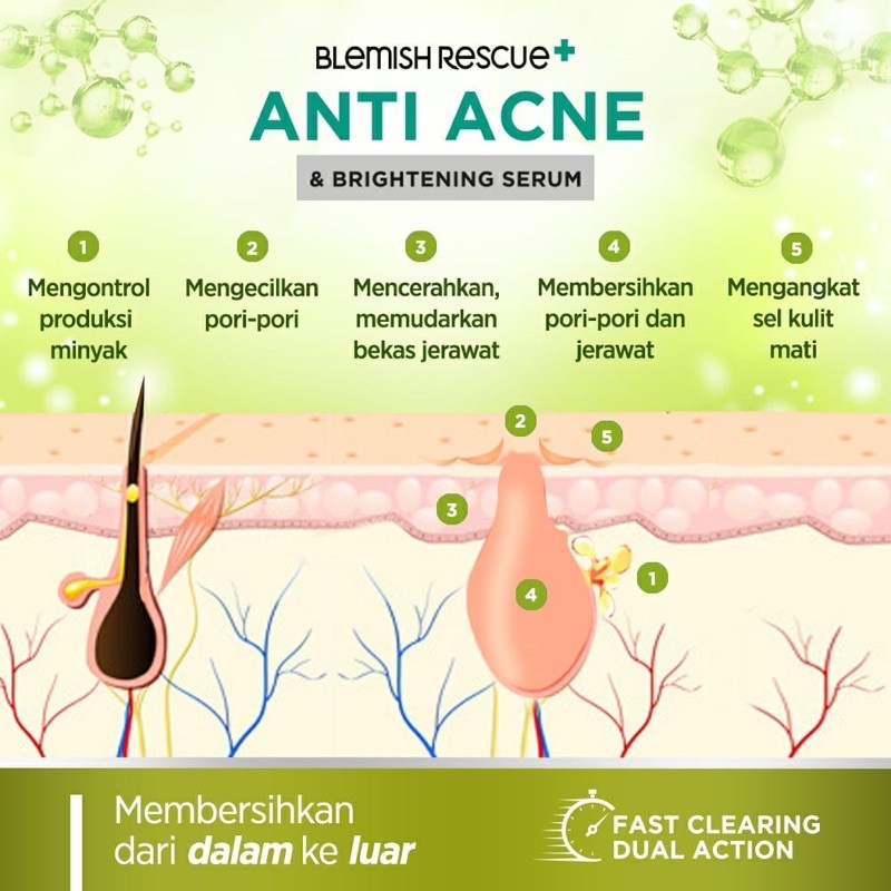 Azarine Anti acne Series Blemish Rescue