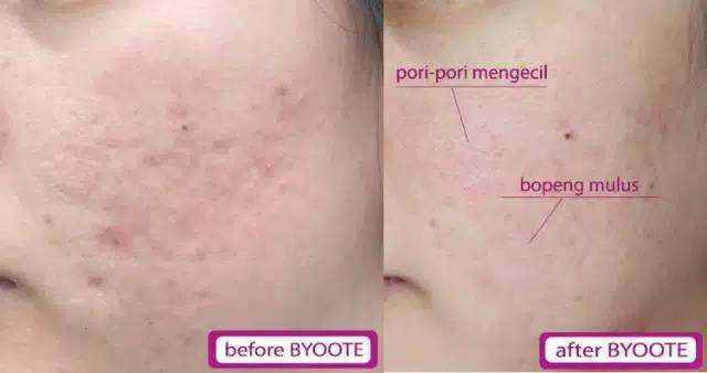 READY STOK !!! BYOOTE (ECER)