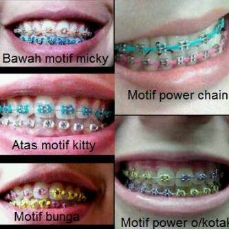 behel lepas pasang 11rban bisa COD order 10 free 1 motif power o dan chain