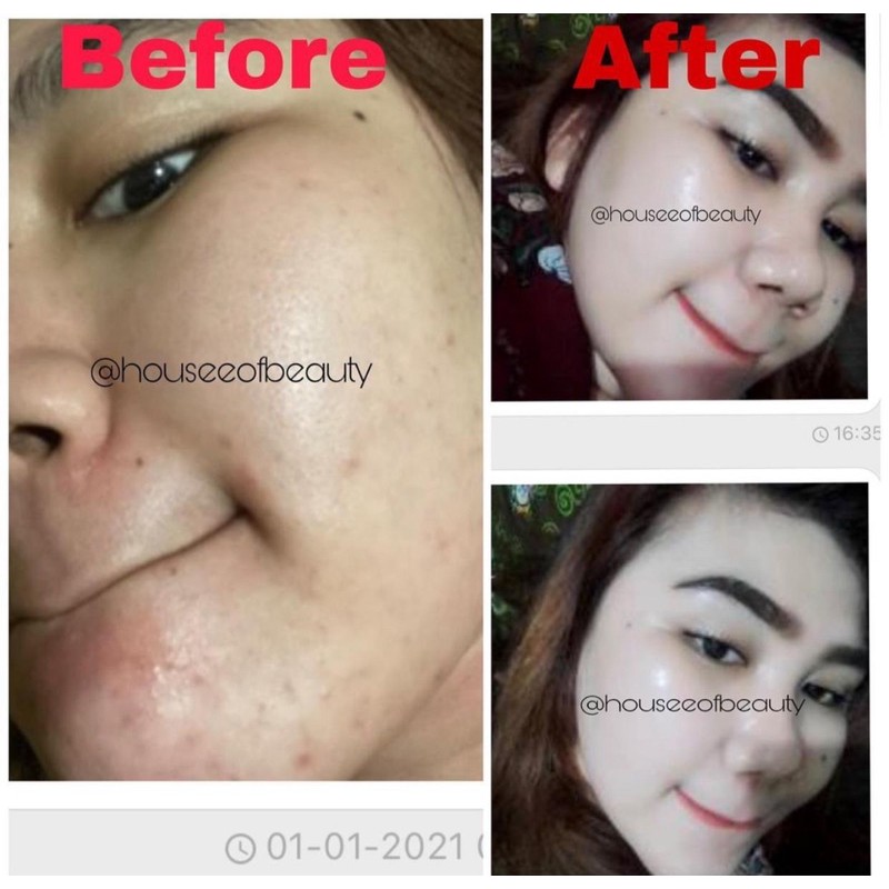 Skincare Cream Pemutih Wajah GLOWING Kosmetik Wanita | NEW SKIN YOUTH REVOLUTION PLUS-1