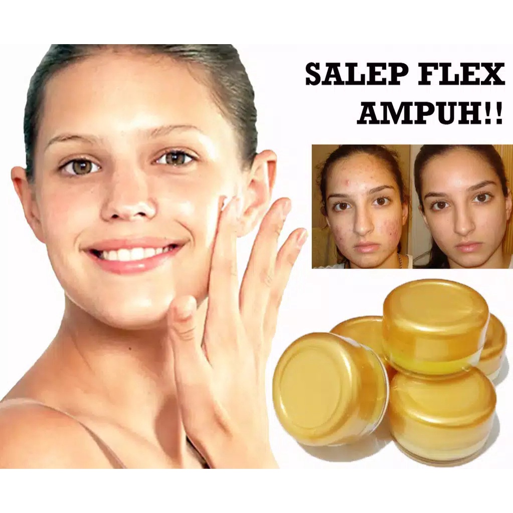 Salep Flek Hitam Membandel - Salep Fleks Untuk Menghilangkan Flex Hitam / Salep Flex Hitam