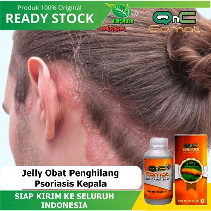 Jelly Obat Penghilang Psoriasis Kepala, Gatel Kulit Kepala, Kulit Kepala Berkerak, Ketombe - GAMAT S