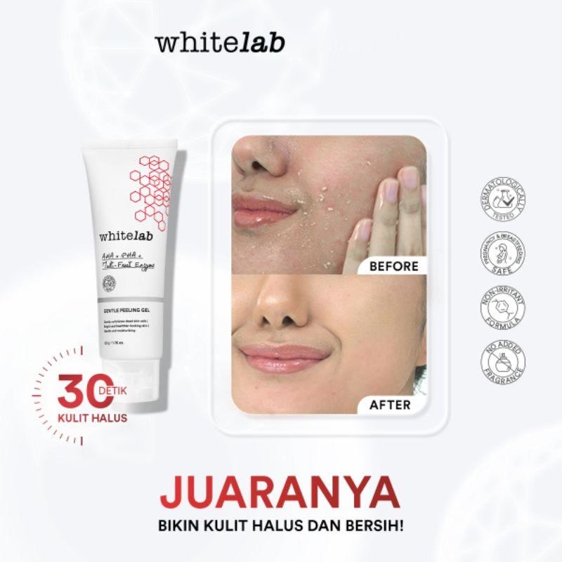 ★ BB ★  Whitelab Gentle Peeling Gel -  Gel Pengangkat Sel Kulit Mati Untuk Kulit Normal, Kering, Sensitif Untuk Kulit Halus, Lembap, Dan Cerah Dengan AHA PHA [BPOM]