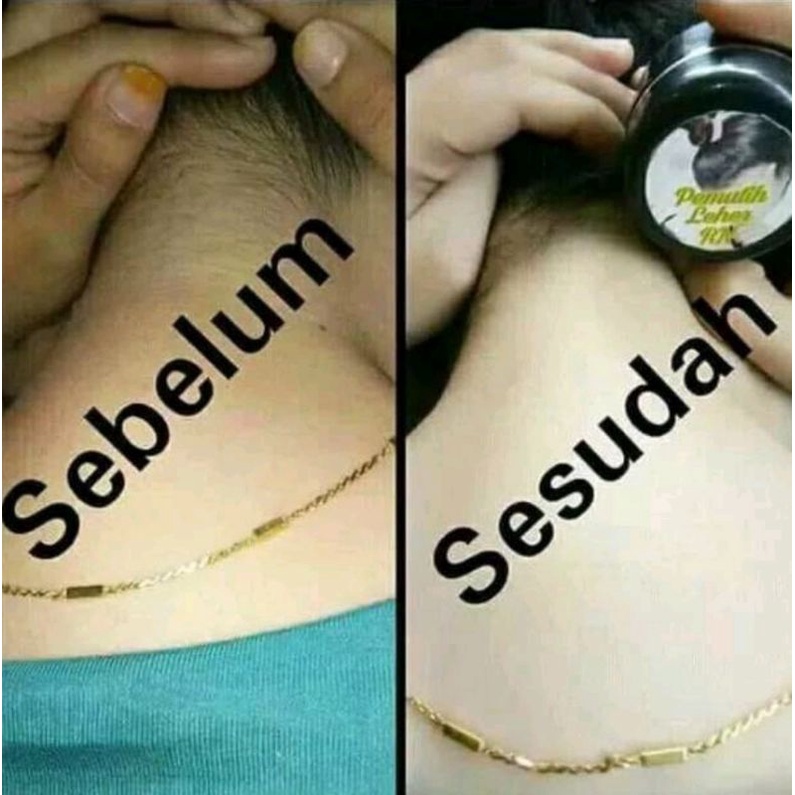 CREAM PEMUTIH LEHER-12ml