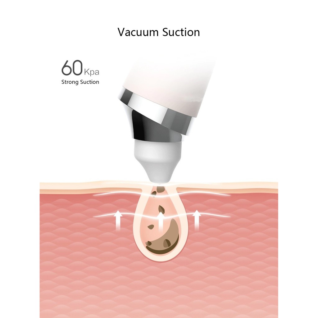 XIAOMI GOODTIME Visual Rechargeable Vacuum Suction Blackheads Remover - Alat Pembersih Komedo