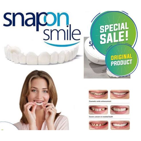 Snap On Smile 100% ORIGINAL Authentic | Snap 'n Smile Gigi Palsu - Sepasang(2Pcs)