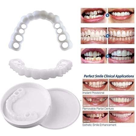 Veneer Snap On Smile Gigi Palsu Silikon Berkualitas 1 Set Pelapis gigi