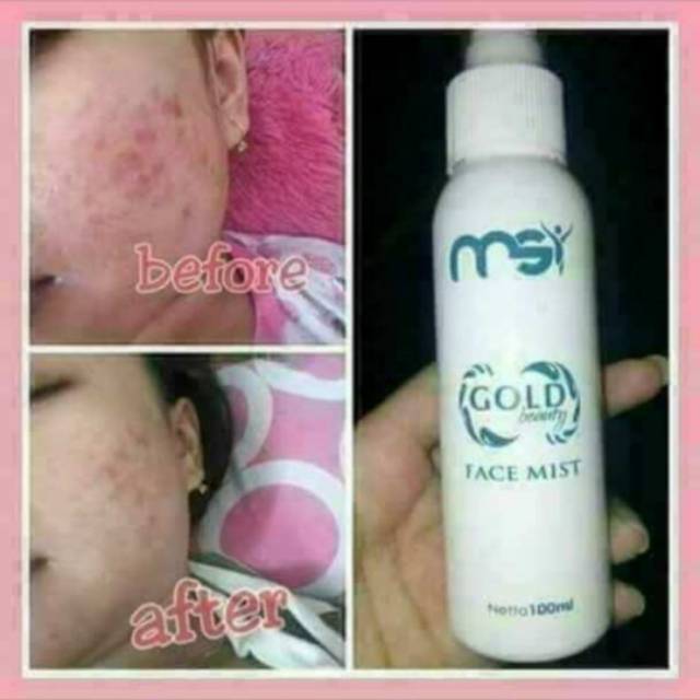 Facemist Msi Original Shopee Indonesia