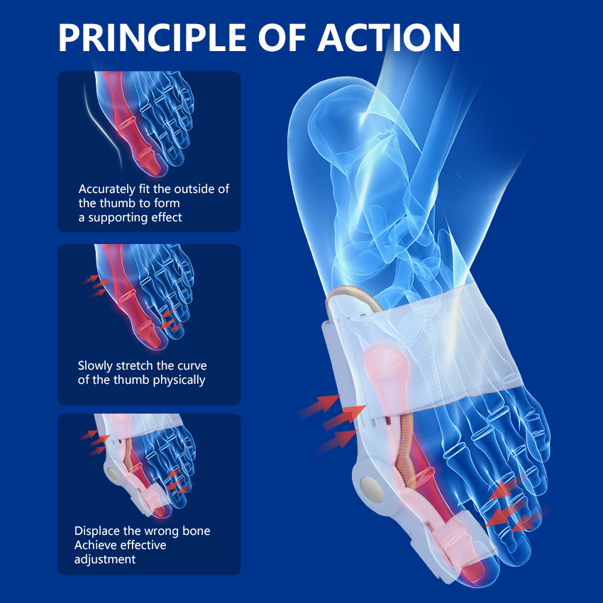 Big Bone Toe Bunion Splint Toe Straightener Corrector Koreksi Hallux Valgus Perlengkapan Ortopedi