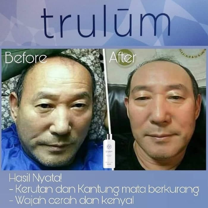 Trulum 5Ml/15Ml/120Ml/Perawatan Kulit Wajah Keriput