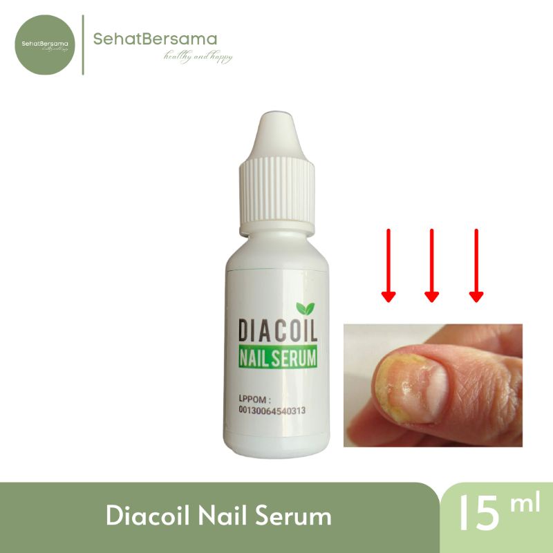DIACOIL NAIL SERUM OBAT JAMUR KUKU CANTENGAN BENGKAK BERNANAH KUKU HITAM