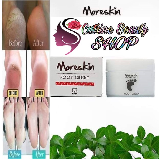 Jual CREAM KAKI PECAH-PECAH KASAR DAN KERING - MORESKIN FOOT CREAM ...