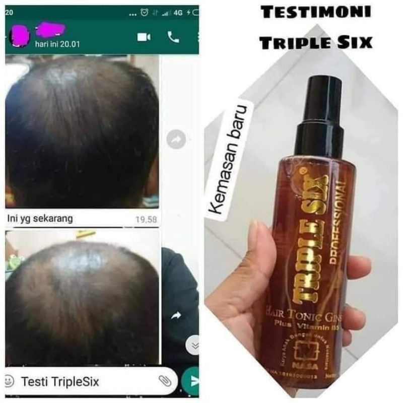 HAIR TONIC PENUMBUH RAMBUT//PELEBAT RAMBUT//RAMBUT PANJANG SEHAT ALAMI//RAMBUT LEBAT SEHAT