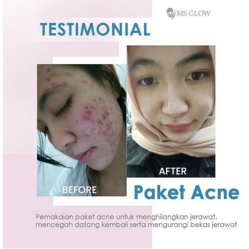 MS GLOW ORI BPOM Free Voucher Telkomsel 1.5GB