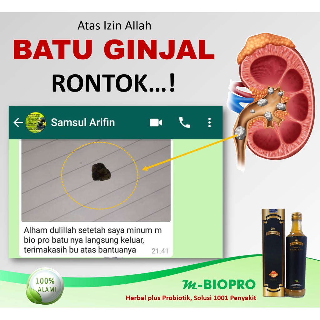 Agen M Biopro | M Biopro Untuk Batu Ginjal | Harga M Biopro | Herbal M Biopro