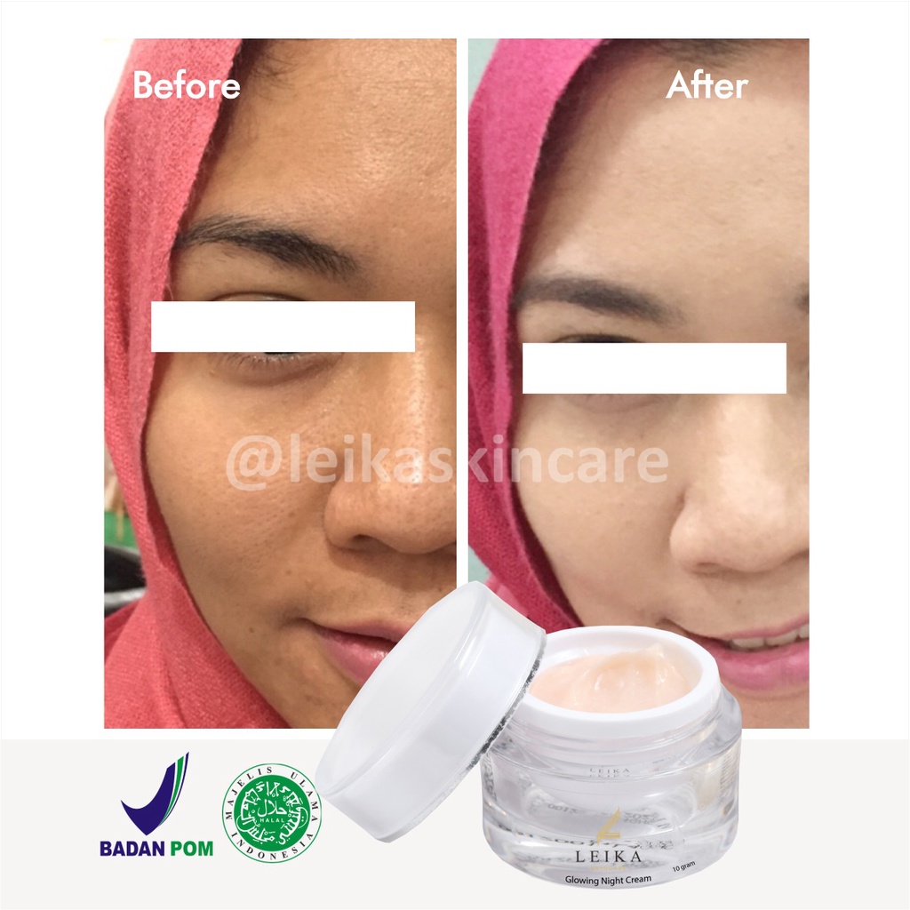 Menakjubkan! Cream Pencerah Wajah Kusam Glowing Cepat untuk Remaja BPOM Pria Wanita Asli Ampuh Krim Pemutih dan Pencerah / Perawatan wajah glowing HALAL MUI