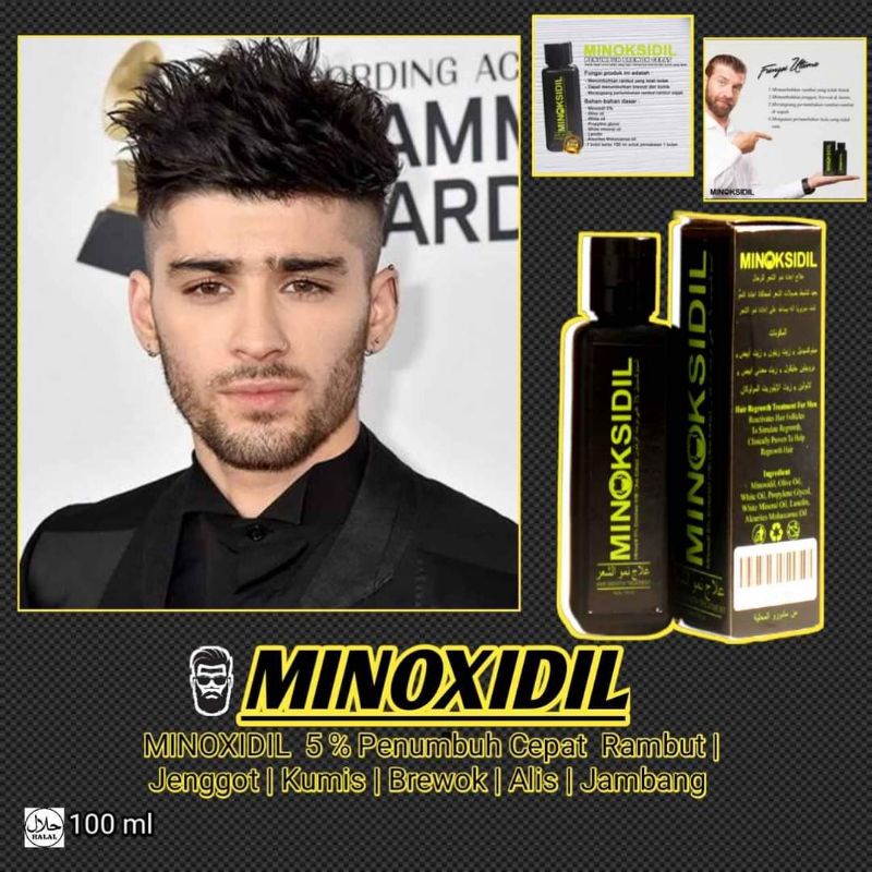 Minoksidil penumbuh rambut