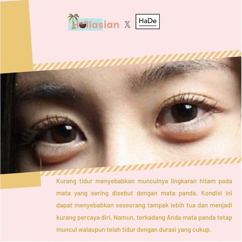 [DIST RESMI] PINEAPPLE EYE FIRMER SERUM HOLLASIAN SERUM MATA HOLLASIAN