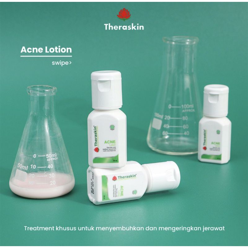 ACNE LOTION THERASKIN | OBAT TOTOL / OBAT OLES JERAWAT BERUNTUSAN