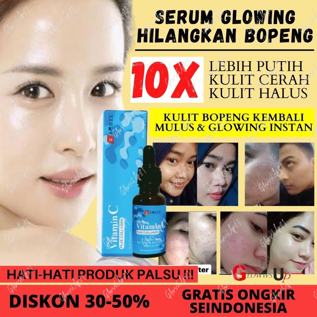 SERUM PENGHILANG BOPENG PEMUTIH WAJAH 3 HARI SYB FORTE SERUM VIT C PLUS COLLAGEN BPOM - ORIGINAL