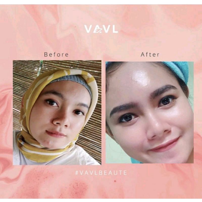 Vavl acne basic / blemish vavl / serum vavl / beauty water vavl