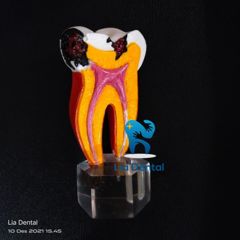 PANTHOM ANATOMI GIGI